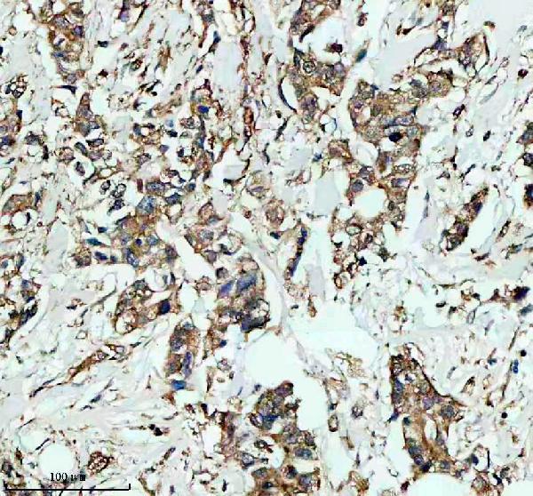 IHC analysis of GSTK1 using anti-GSTK1 antibody (A06112-3)