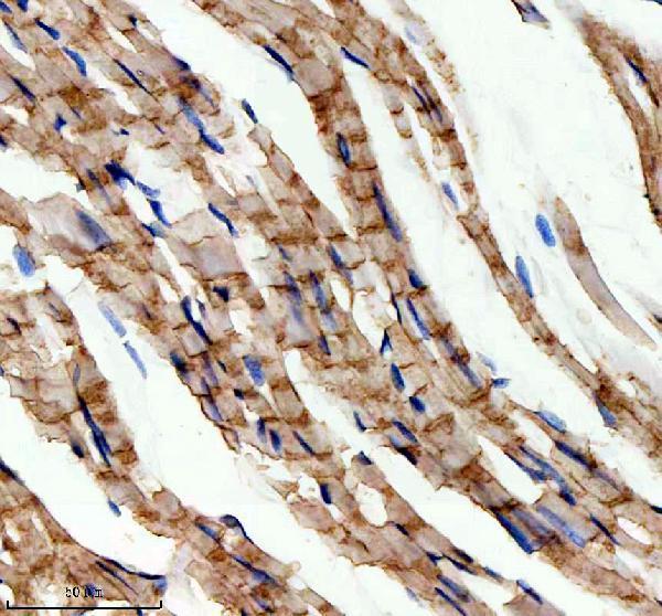 IHC analysis of GSTK1 using anti-GSTK1 antibody (A06112-3)