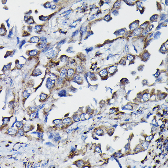 a06112 gstk1 primary antiboties ihc testing 2