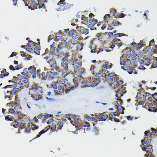 a06112 gstk1 primary antiboties ihc testing 4
