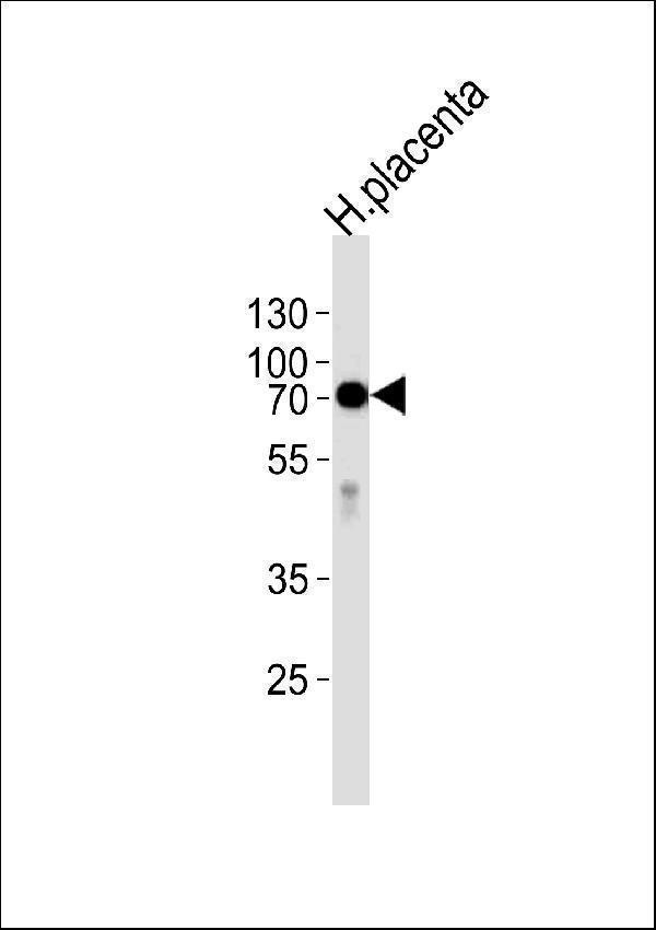 Western blot analysis of lysate from human placenta tissue,using ALPI Antibody (Center)