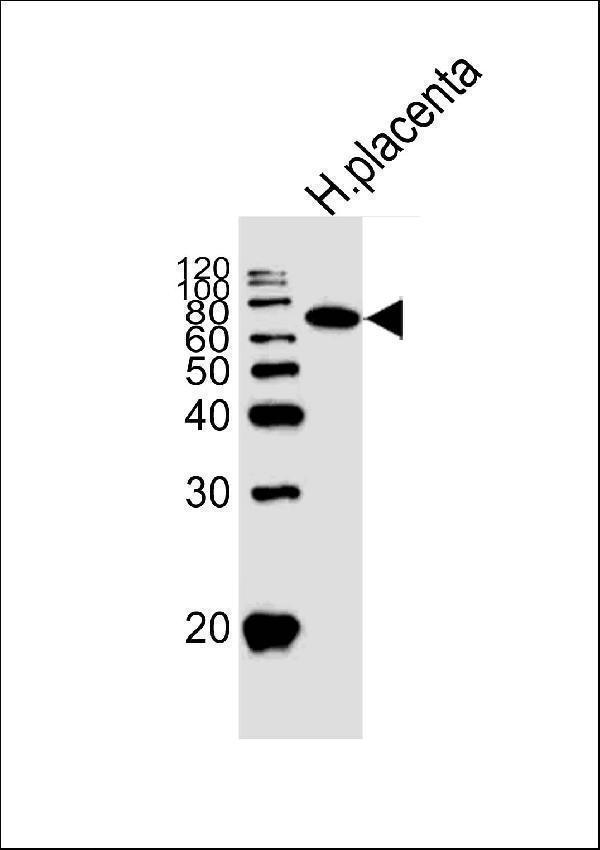 Western blot analysis of lysate from human placenta tissue lysate, using ALPI Antibody (Center)