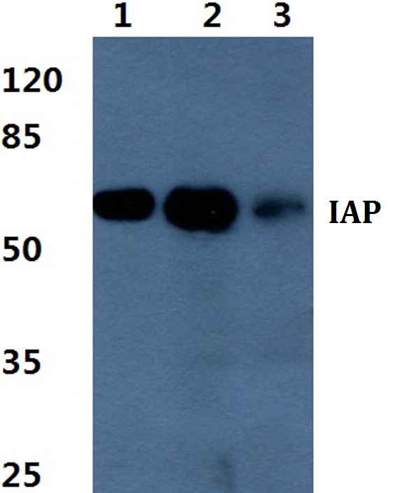 Western blot (WB) analysis of IAP polyclonal antibody at 1:500 dilution
Lane1:HEK293T cell lysate
Lane2:Raw264
