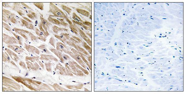 a06116 arhgap1 primary antibodies ihc testing 1