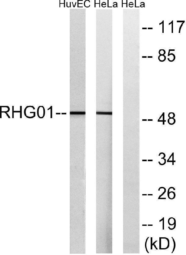 a06116 arhgap1 primary antibodies wb testing 2