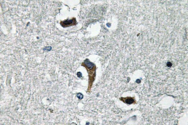 Immunohistochemistry analysis of MaxiKβ antibody in paraffin-embedded human brain tissue