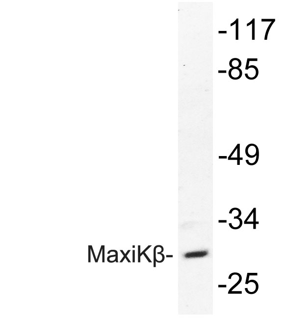Western blot analysis of lysate from HepG2 cells, using MaxiKβ antibody