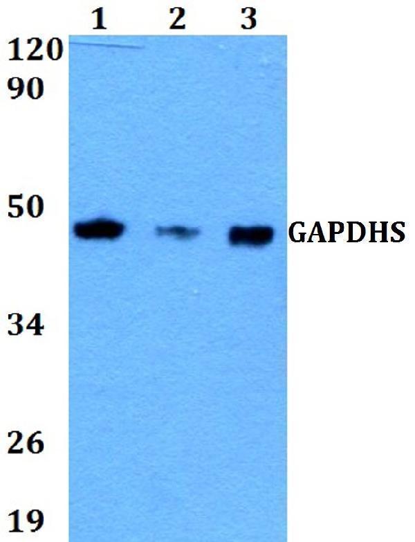 Western blot (WB) analysis of GAPDHS polyclonal antibody at 1:500 dilution
Lane1:HEK293T whole cell lysate
Lane2:sp2/0 whole cell lysate 
Lane3:pc12 whole cell lysate 