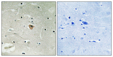 Immunohistochemistry validation of KIF13B using Anti-Kinesin-like protein KIF13B KIF13B Antibody (A06122-1)
