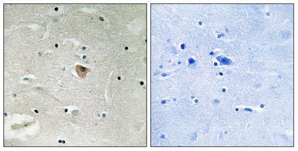 a06122 kif13b primary antibodies ihc testing 1
