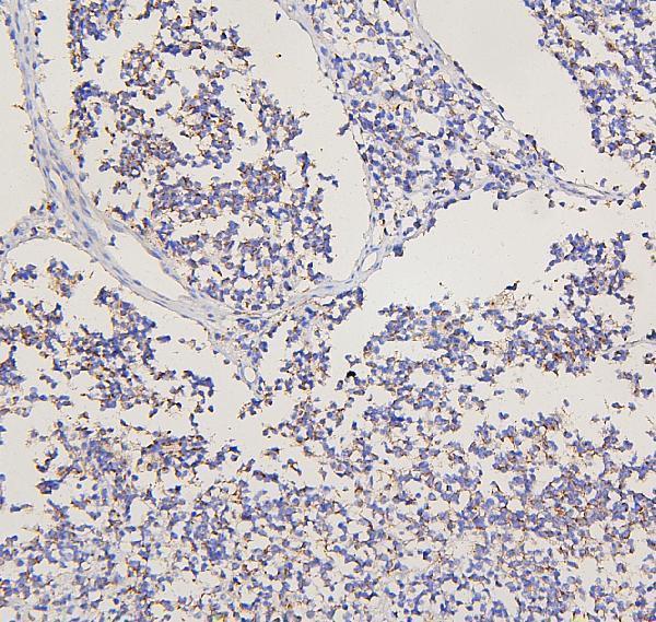 a06123 1 grm2 primary antibodies ihc testing 2