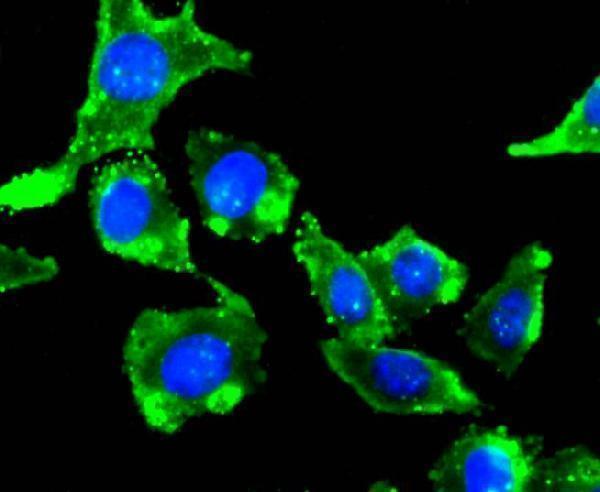 a06123 3 grm2 primary antiboties icc testing 1