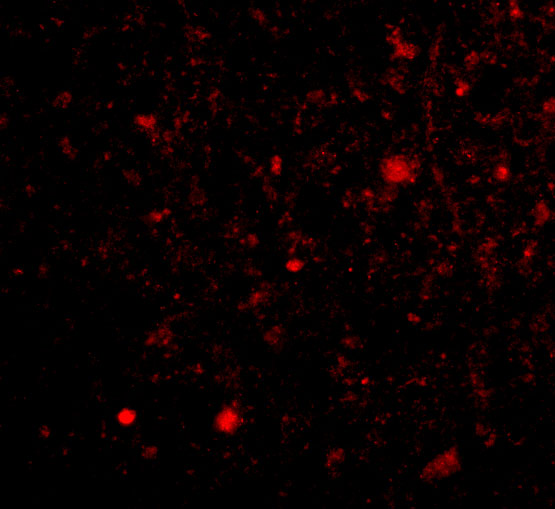 Immunofluorescence of TOCA-1 in Human Brain cells with TOCA-1 antibody at 20 μg/mL