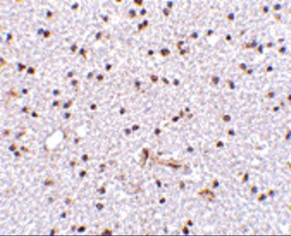 Immunohistochemistry of TOCA-1 in human brain tissue with TOCA-1 antibody at 2