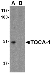 Western blot analysis of TOCA-1 in mouse brain tissue lysate with in (A) the absence and (B) the presence of blocking peptide with TOCA-1 antibody at 1 μg/mL