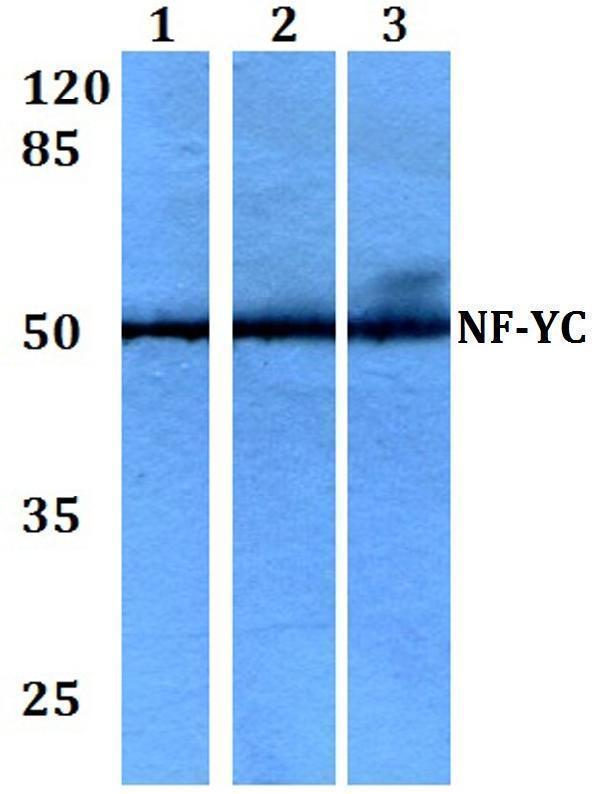 Western blot (WB) analysis of NF-YC (W85) polyclonal antibody at 1:500 dilution
Lane1:HEK293T whole cell lysate
Lane2:Raw264