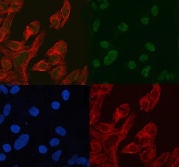 a06129 1 ash2l primary antibodies if testing 20
