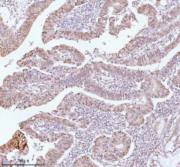 a06129 1 ash2l primary antibodies ihc testing 10