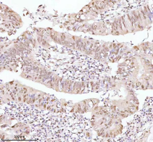 a06129 1 ash2l primary antibodies ihc testing 11
