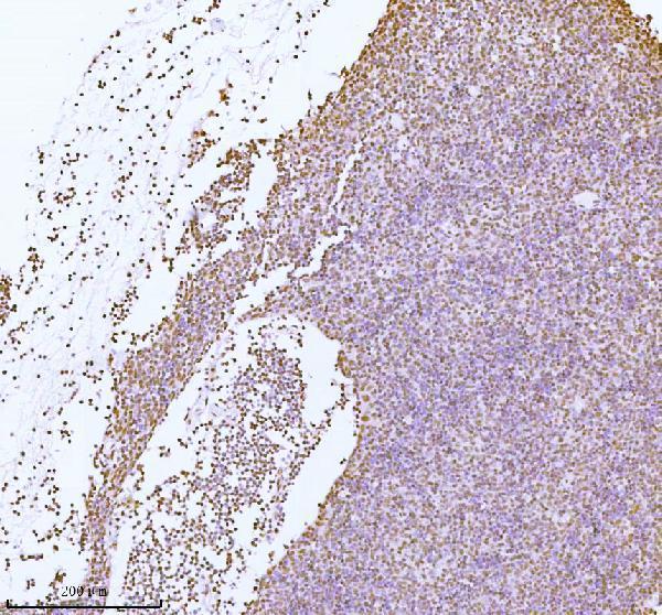 a06129 1 ash2l primary antibodies ihc testing 12