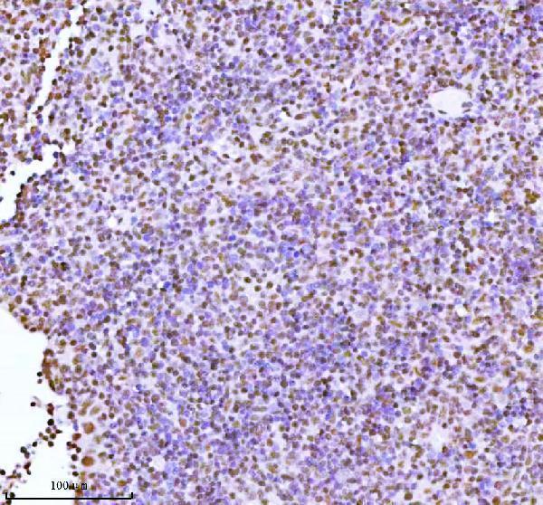 a06129 1 ash2l primary antibodies ihc testing 13