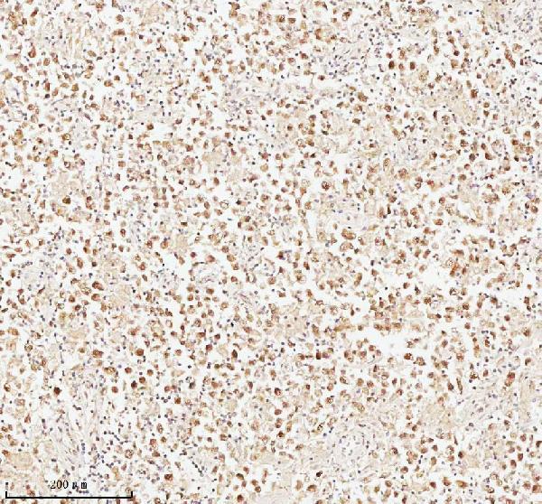 a06129 1 ash2l primary antibodies ihc testing 14