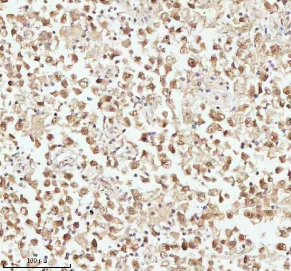 a06129 1 ash2l primary antibodies ihc testing 15