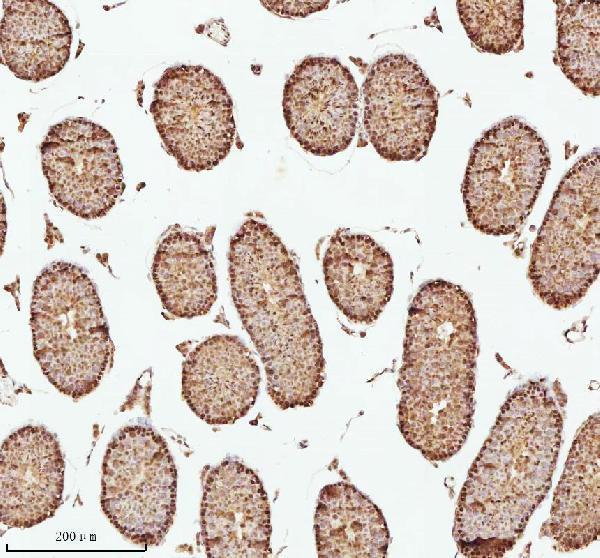 a06129 1 ash2l primary antibodies ihc testing 16