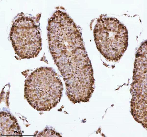 a06129 1 ash2l primary antibodies ihc testing 17