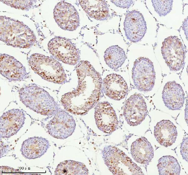 a06129 1 ash2l primary antibodies ihc testing 18