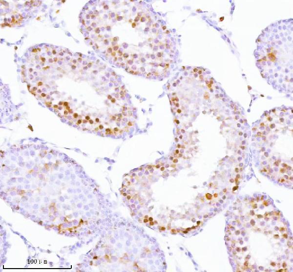 a06129 1 ash2l primary antibodies ihc testing 19