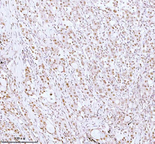 a06129 1 ash2l primary antibodies ihc testing 2
