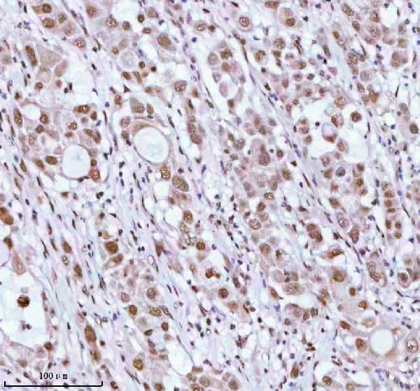 a06129 1 ash2l primary antibodies ihc testing 3