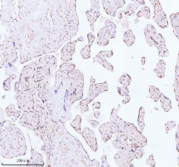 a06129 1 ash2l primary antibodies ihc testing 4