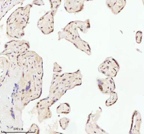 a06129 1 ash2l primary antibodies ihc testing 5