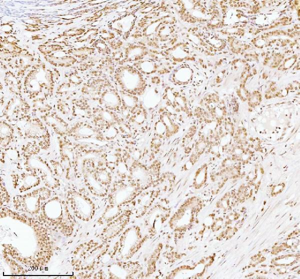 a06129 1 ash2l primary antibodies ihc testing 6