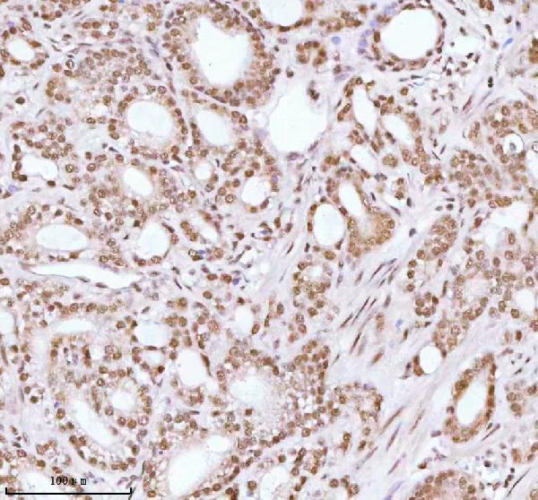 a06129 1 ash2l primary antibodies ihc testing 7