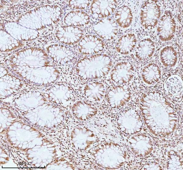 a06129 1 ash2l primary antibodies ihc testing 8