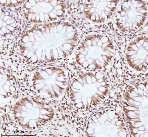 a06129 1 ash2l primary antibodies ihc testing 9