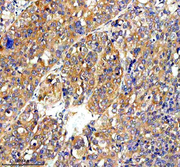  IHC analysis of RAPH1 using anti-RAPH1 antibody (A06130-1)