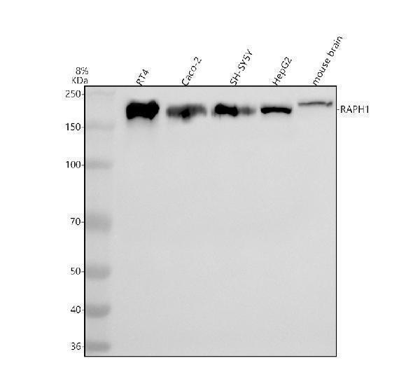  Western blot analysis of RAPH1 using anti-RAPH1 antibody (A06130-1)