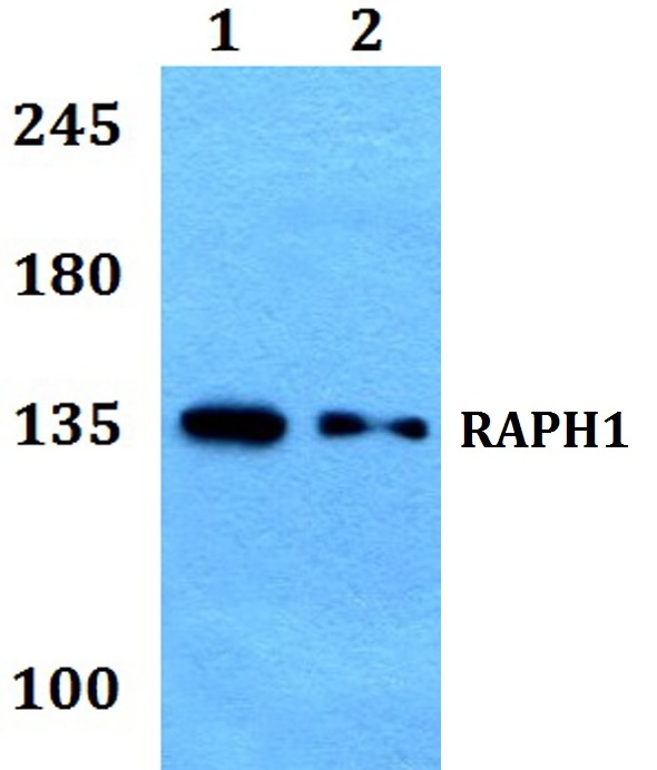 Western blot (WB) analysis of RAPH1 polyclonal antibody at 1:500 dilution
Lane1:HepG2 whole cell lysate
Lane2:H9C2 whole cell lysate