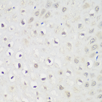 Immunohistochemistry of paraffin-embedded rat stomach using KPNA3 Rabbit pAb  at dilution of 1:100 
