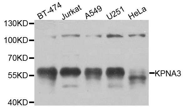 Western blot analysis of extracts of various cell lines, using KPNA3 antibody  at 1:1000 dilution