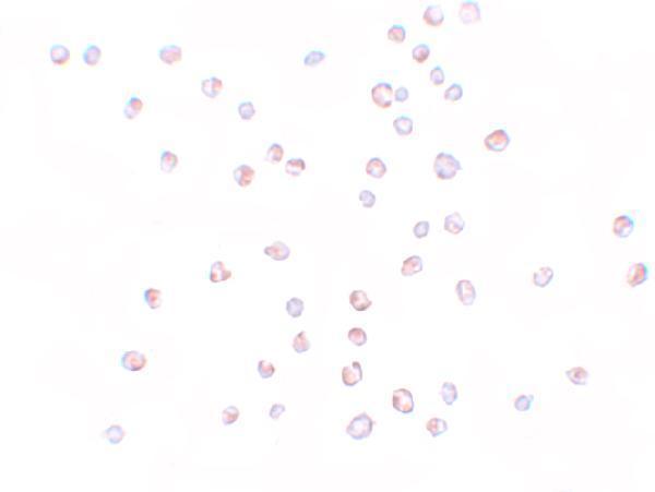 Immunocytochemistry of KPNA3 in HeLa cells with KPNA3 antibody at 10 μg/mL