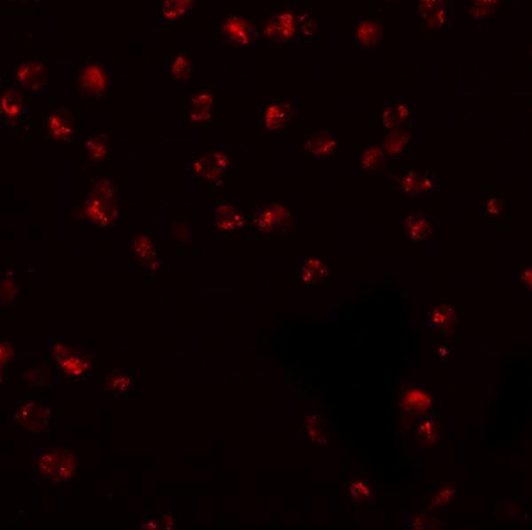 Immunofluorescence of KPNA3 in EL4 cells with KPNA3 antibody at 20 μg/mL