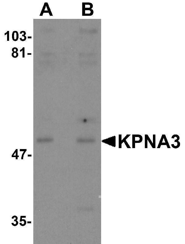 Western blot analysis of KPNA3 in EL4 cell lysate with KPNA3 antibody at (A) 1 and (B) 2 μg/mL