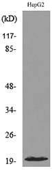 Western blot analysis of lysate from HepG2 cells, using DUSP3 Antibody