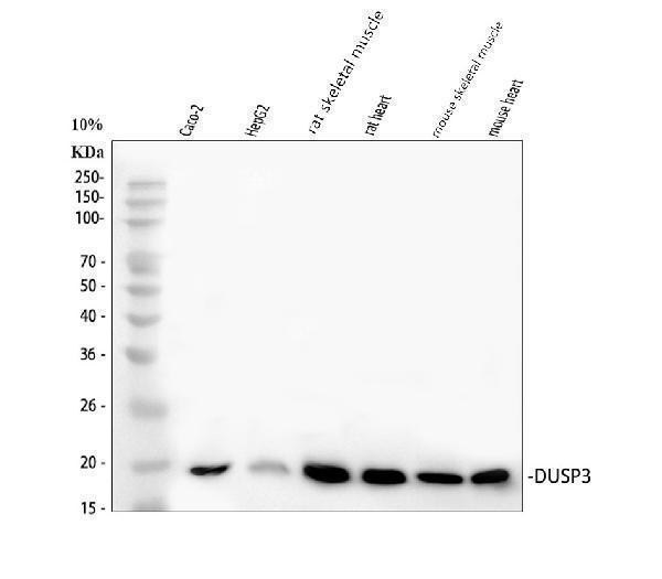  Western blot analysis of DUSP3 using anti-DUSP3 antibody (A06135)