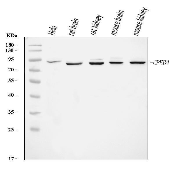  Western blot analysis of CPEB4 using anti-CPEB4 antibody (A06139-2)